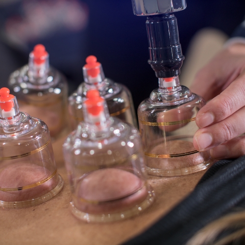 Cupping - Platinum Physical Therapy At Ashland Hopkinton Milford MA