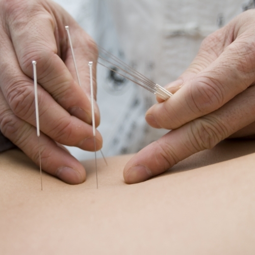 Therafit Physical Therapy Dry Needling in Lowell, MA